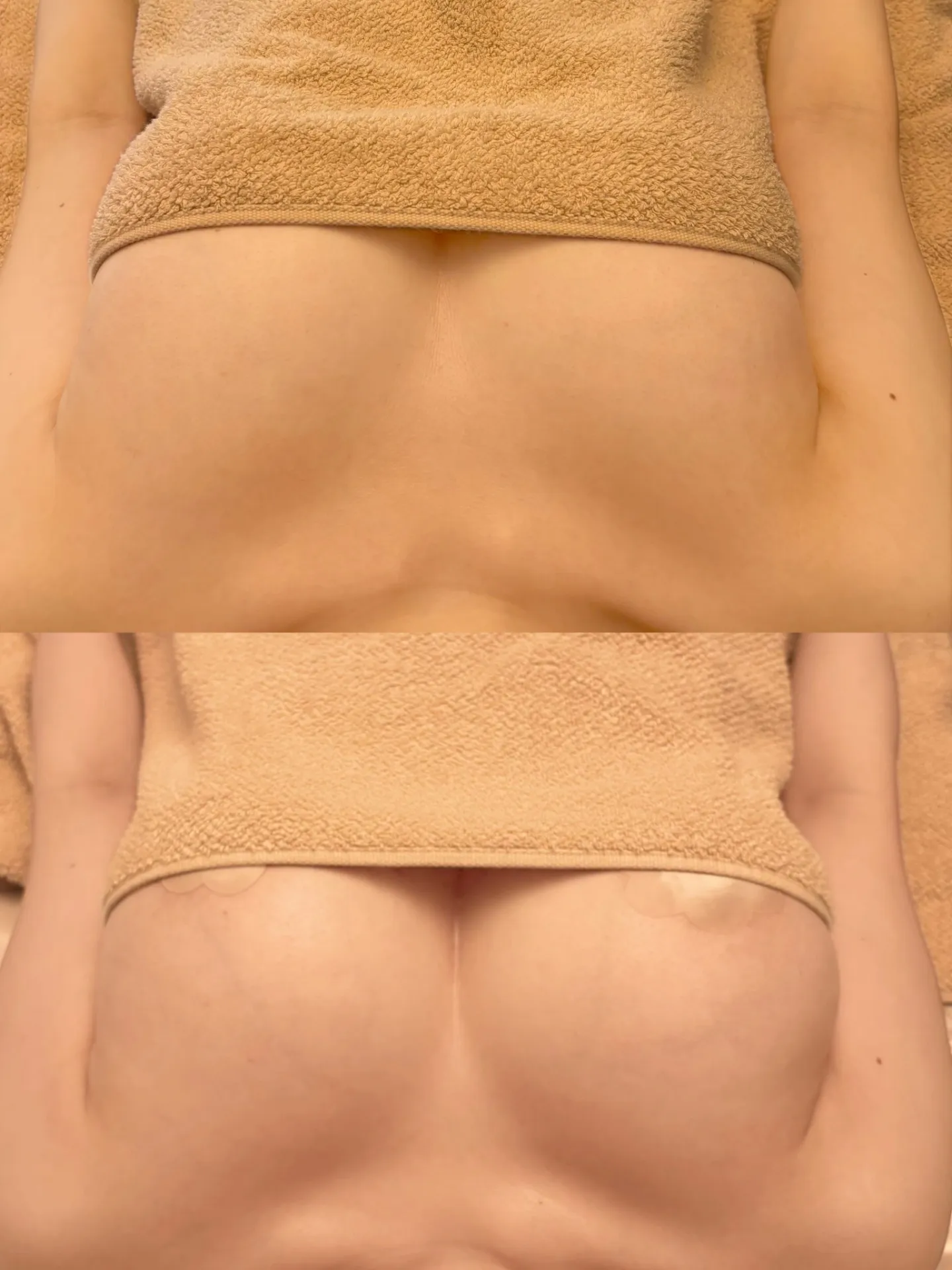 バストアップの効果とエステサロンで実感する自然な美しさの作り方